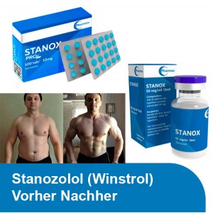 Stanozolol (Winstrol) Vorher Nachher Stanozolol (Winstrol) Vorher Nachher